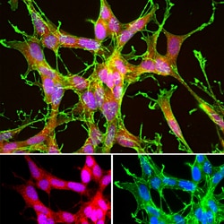 Invitrogen DJ-1 Polyclonal Antibody:Antibodies:Primary Antibodies