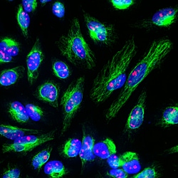Invitrogen Fibrillarin Polyclonal Antibody 500 &mu;L; Unconjugated:Antibodies,