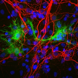 Invitrogen Galectin 3 Polyclonal Antibody 500 &mu;L; Unconjugated:Antibodies,
