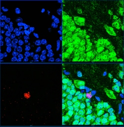 Invitrogen Ki-67 Polyclonal Antibody:Antibodies:Primary Antibodies