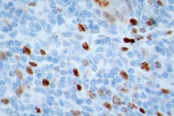 Invitrogen Ki-67 Polyclonal Antibody:Antibodies:Primary Antibodies