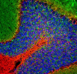 Invitrogen NEFL Polyclonal Antibody:Antibodies:Primary Antibodies