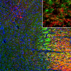 Invitrogen SLC6A4 Polyclonal Antibody:Antibodies:Primary Antibodies
