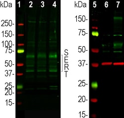 Invitrogen SLC6A4 Polyclonal Antibody:Antibodies:Primary Antibodies