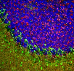 Invitrogen beta Synuclein Polyclonal Antibody:Antibodies:Primary Antibodies