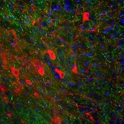 Invitrogen Tyrosine Hydroxylase Polyclonal Antibody:Antibodies:Primary
