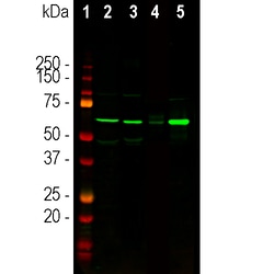 Invitrogen Tyrosine Hydroxylase Polyclonal Antibody:Antibodies:Primary