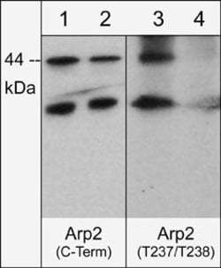 Invitrogen Arp2 Polyclonal Antibody 100 &mu;L; Unconjugated:Antibodies,