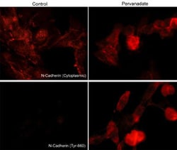 Invitrogen Phospho-N-cadherin/E-cadherin (Tyr820, Tyr835, Tyr860) Polyclonal