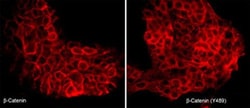 Invitrogen Phospho-beta Catenin/gamma Catenin (Tyr489, Tyr480) Polyclonal