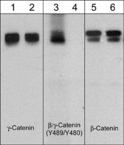 Invitrogen Phospho-beta Catenin/gamma Catenin (Tyr489, Tyr480) Polyclonal