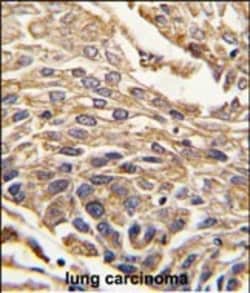 Invitrogen Arylsulfatase B Polyclonal Antibody 400 &mu;L | Buy Online | Invitrogen&trade; | Fisher Scientific