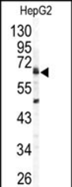 Invitrogen Arylsulfatase B Polyclonal Antibody 400 &mu;L | Buy Online | Invitrogen&trade; | Fisher Scientific