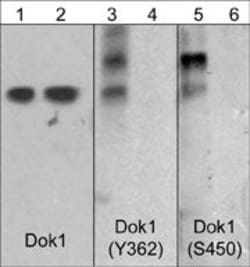 Phospho-DOK1 (Ser450) Polyclonal Antibody:Antibodies, Polyclonal