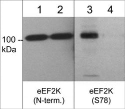 Invitrogen Phospho-EEF2K (Ser78) Polyclonal Antibody 100 &mu;L; Unconjugated:Antibodies,