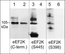 Phospho-EEF2K (Ser398) Polyclonal Antibody 100 &mu;L | Buy Online | Invitrogen | Fisher Scientific