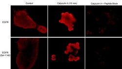 Invitrogen Phospho-EGFR (Ser1142) Polyclonal Antibody 100 &mu;L; Unconjugated:Antibodies,