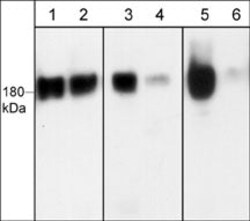 Invitrogen Phospho-EGFR (Ser1142) Polyclonal Antibody 100 &mu;L; Unconjugated:Antibodies,