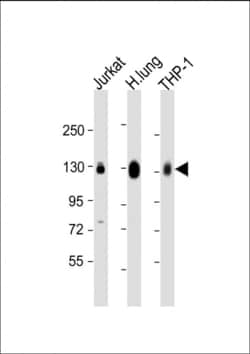 Invitrogen CD31 Polyclonal Antibody 400 &mu;L; Unconjugated:Antibodies,