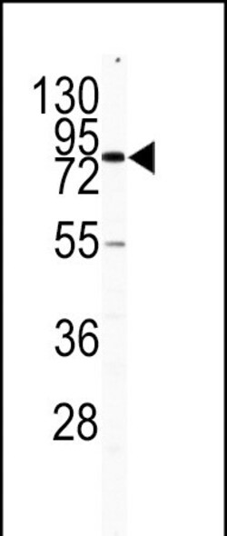 Invitrogen CD31 Polyclonal Antibody 400 &mu;L; Unconjugated:Antibodies,