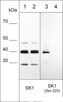 Invitrogen Phospho-SPHK1 (Ser225) Polyclonal Antibody 100 &mu;L | Buy Online | Invitrogen&trade; | Fisher Scientific