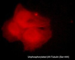 Invitrogen Beta III Tubulin Polyclonal Antibody 100 &mu;L; Unconjugated:Antibodies,