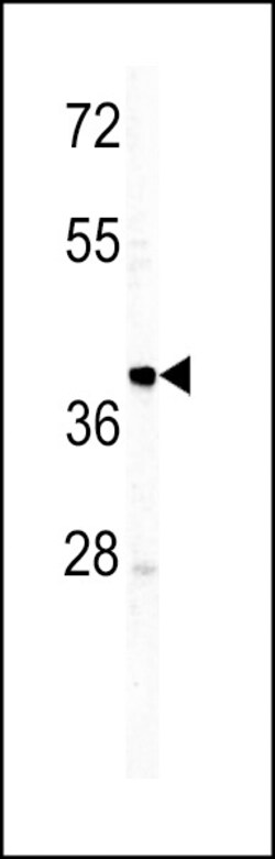 Invitrogen Rabbit anti-Human IgM Secondary Antibody 400 &mu;L; Unconjugated:Antibodies,