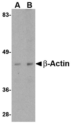 Invitrogen beta Actin Polyclonal Antibody 100 &mu;g | Buy Online | Invitrogen&trade; | Fisher Scientific