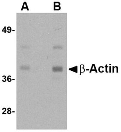 Invitrogen beta Actin Polyclonal Antibody 100 &mu;g; Unconjugated:Antibodies,