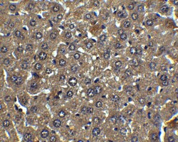 Invitrogen Albumin Polyclonal Antibody 100 &mu;g | Buy Online | Invitrogen&trade; | Fisher Scientific