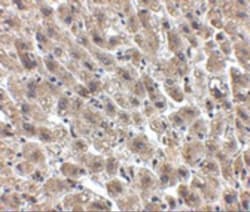 Invitrogen Albumin Polyclonal Antibody 100 &mu;g | Buy Online | Invitrogen&trade; | Fisher Scientific