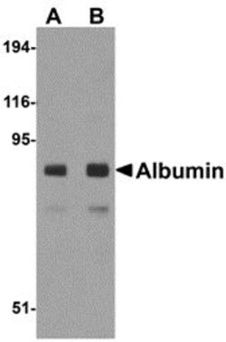 Invitrogen Albumin Polyclonal Antibody 100 &mu;g | Buy Online | Invitrogen&trade; | Fisher Scientific