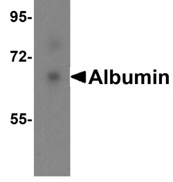Invitrogen Albumin Polyclonal Antibody 100 &mu;g | Buy Online | Invitrogen&trade; | Fisher Scientific