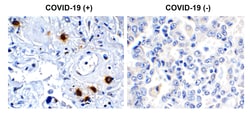 Invitrogen SARS-CoV-2 NSP7 Polyclonal Antibody 100 &mu;g; Unconjugated:Antibodies,