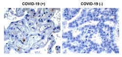 Invitrogen SARS-CoV-2 NSP9 Polyclonal Antibody 100 &mu;g; Unconjugated:Antibodies,