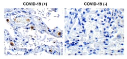 Invitrogen SARS-CoV-2 NSP16 Polyclonal Antibody 100 &mu;g; Unconjugated:Antibodies,