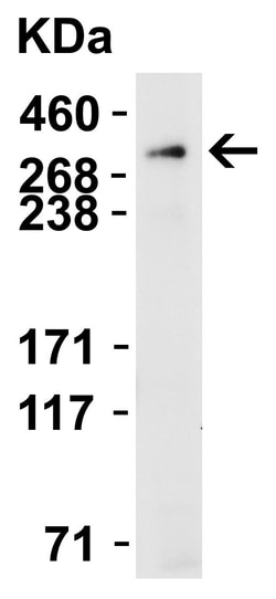Invitrogen PIEZO2 Polyclonal Antibody 100 &mu;g; Unconjugated:Anticorps,