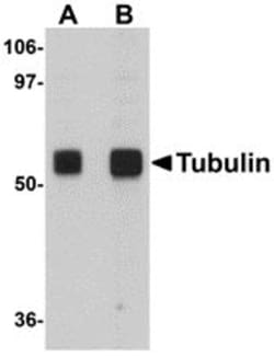 Invitrogen alpha Tubulin Polyclonal Antibody 100 &mu;g; Unconjugated:Antibodies,