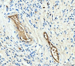 Invitrogen HBA1/HBA2 Polyclonal Antibody 100 &mu;g; Unconjugated:Antibodies,