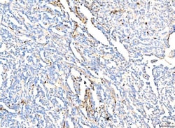 Invitrogen HBA1/HBA2 Polyclonal Antibody 100 &mu;g; Unconjugated:Antibodies,