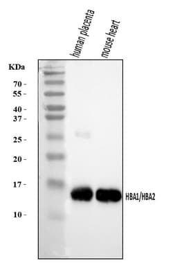 Invitrogen HBA1/HBA2 Polyclonal Antibody 100 &mu;g; Unconjugated:Antibodies,