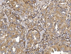 Invitrogen MEFV Polyclonal Antibody 100 &mu;g; Unconjugated:Antibodies,