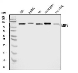 Invitrogen MEFV Polyclonal Antibody 100 &mu;g; Unconjugated:Antibodies,