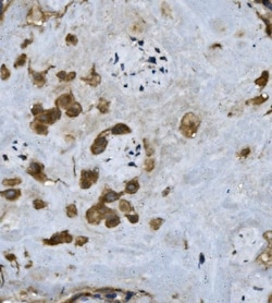 Invitrogen Fibrinogen alpha chain Polyclonal Antibody 100 &mu;g; Unconjugated:Antibodies,