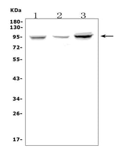 Invitrogen Fibrinogen alpha chain Polyclonal Antibody 100 &mu;g; Unconjugated:Antibodies,