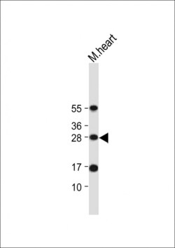 Invitrogen OAZ1 Polyclonal Antibody 400 &mu;L | Buy Online | Invitrogen&trade; | Fisher Scientific