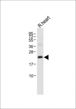 Invitrogen OAZ1 Polyclonal Antibody 400 &mu;L | Buy Online | Invitrogen&trade; | Fisher Scientific