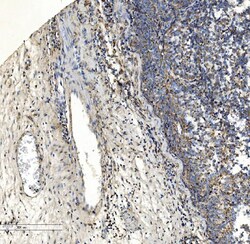 Invitrogen COL7A1 Polyclonal Antibody 100 &mu;g; Unconjugated:Antibodies,