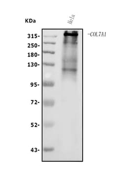 Invitrogen COL7A1 Polyclonal Antibody 100 &mu;g; Unconjugated:Antibodies,