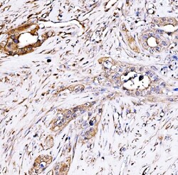 Invitrogen PAK2 Polyclonal Antibody 100 &mu;g; Unconjugated:Antibodies,